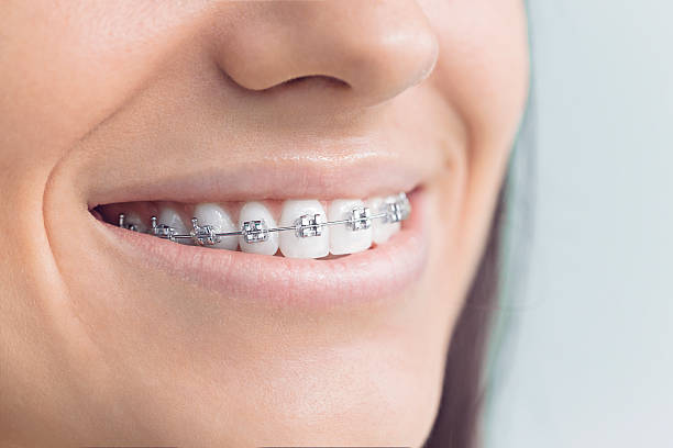 Best Teeth Whitening  in Bidwell, OH